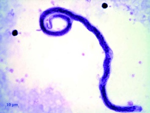 Abb 1: Mikrofilarie von Loa loa.