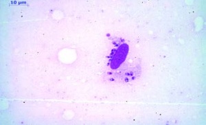 Abb 3: Aus einem rupturierten Makrophagen freigesetzte amastigote Leishmanien.