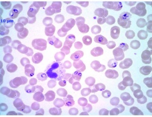 Abb 9: Blutausstrich nach Giemsa-Färbung: morphologisch typische Trophozoiten (Ringformen).