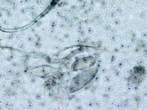 Abb 10: Mikroskopisches Bild nach Filtrationsanreicherung aus Sammelurin: Typische Eier von Schistosoma haematobium.