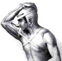 Das Gestell zur Fixierung des Arms an den Kopf wird nach 10 bis 20 Tagen abmontiert und der Lappenstiel am Oberarm abgetrennt.