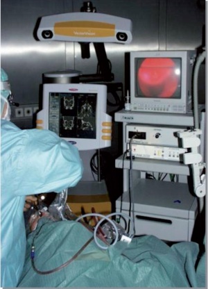 Abb 6: Intraoperatives Set up mit Endoskopieturm und intraoperativer Navigation für die endoskopische navigierte Versorgung von Frontobasisdefekten.