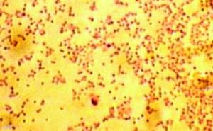 Fallbericht: Unklares Fieber – Tularämie?