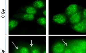 Expression des heterogenen nukleären Ribo-nukleo-proteins K fördert karzinogene Eigenschaften von Mund- und Rachenraumkarzinomen