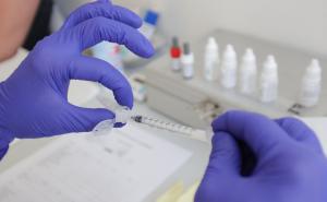 Allergologische Testung bei Verdacht auf Allergie ­gegen COVID-19-Impfstoff