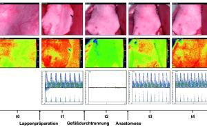 Vergleich von hyperspektraler Bildgebung und Mikro-Doppler-Sonografie zum Perfusionsmonitoring mikrovaskulärer Transplantate in einem in-vivo Kleintier-Modell