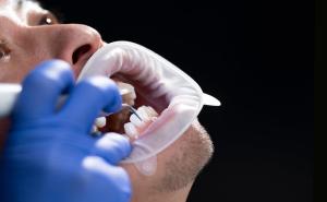 Innovation in der Prophylaxe: Ivoclar stellt Neuheit für die professionelle Zahnreinigung vor
