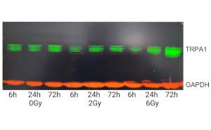 TRP-Kanäle (transient receptor potential channels) als neues therapeutisches Ziel zur Behandlung der akuten Strahlenkrankheit