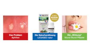 Aphthe, Apthe oder Afte? Hauptsache weg damit!