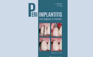GBT IN PERI-IMPLANT PATHOLOGY