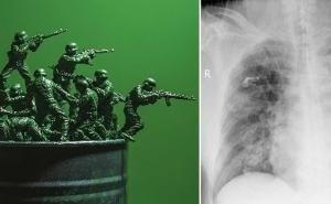 Force Health Protection in der Landes- und Bündnisverteidigung: „Die hässlichen Fünf“ Erkrankungsgruppen – was ist zu tun?