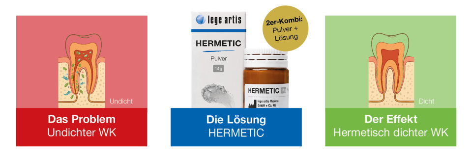 Dicht, dicht, dicht: HERMETischer WK-Verschluss
