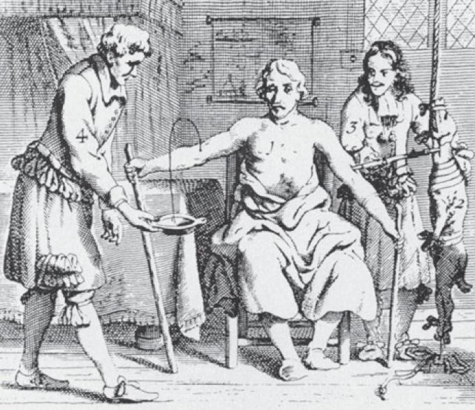 Zeitgenössische Darstellung einer Tierbluttransfusion (17. Jahrhundert)